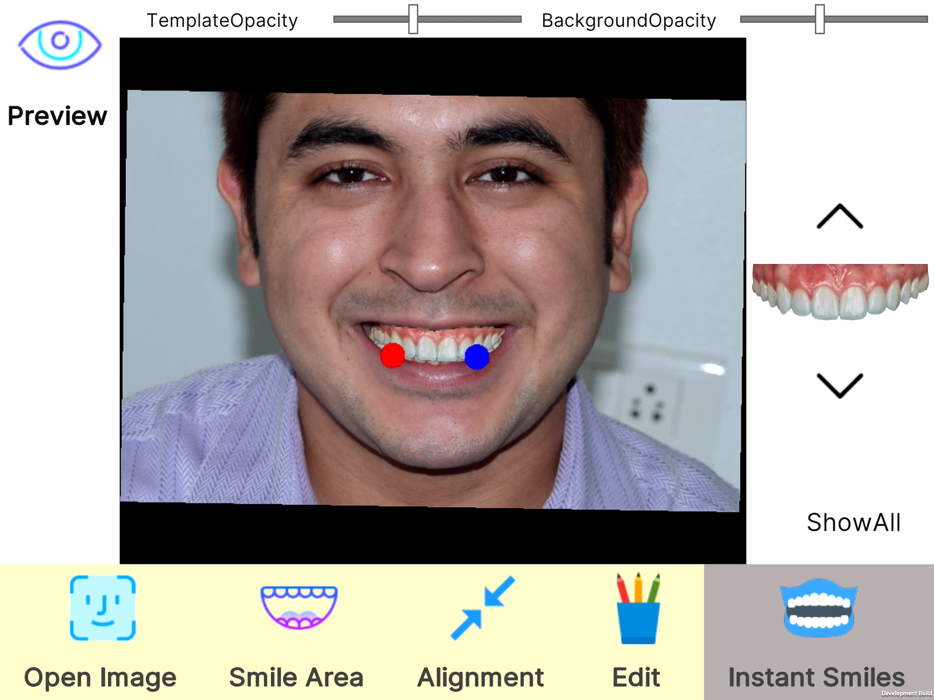 InstantSmiles App development